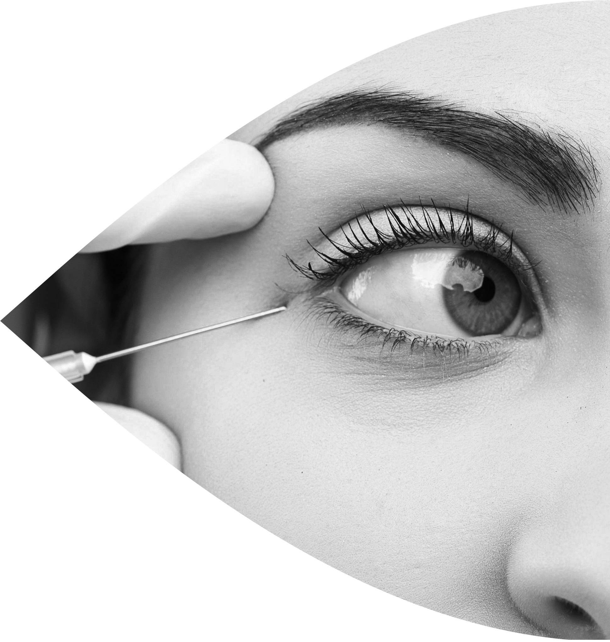 An open eye: Parcours Patient